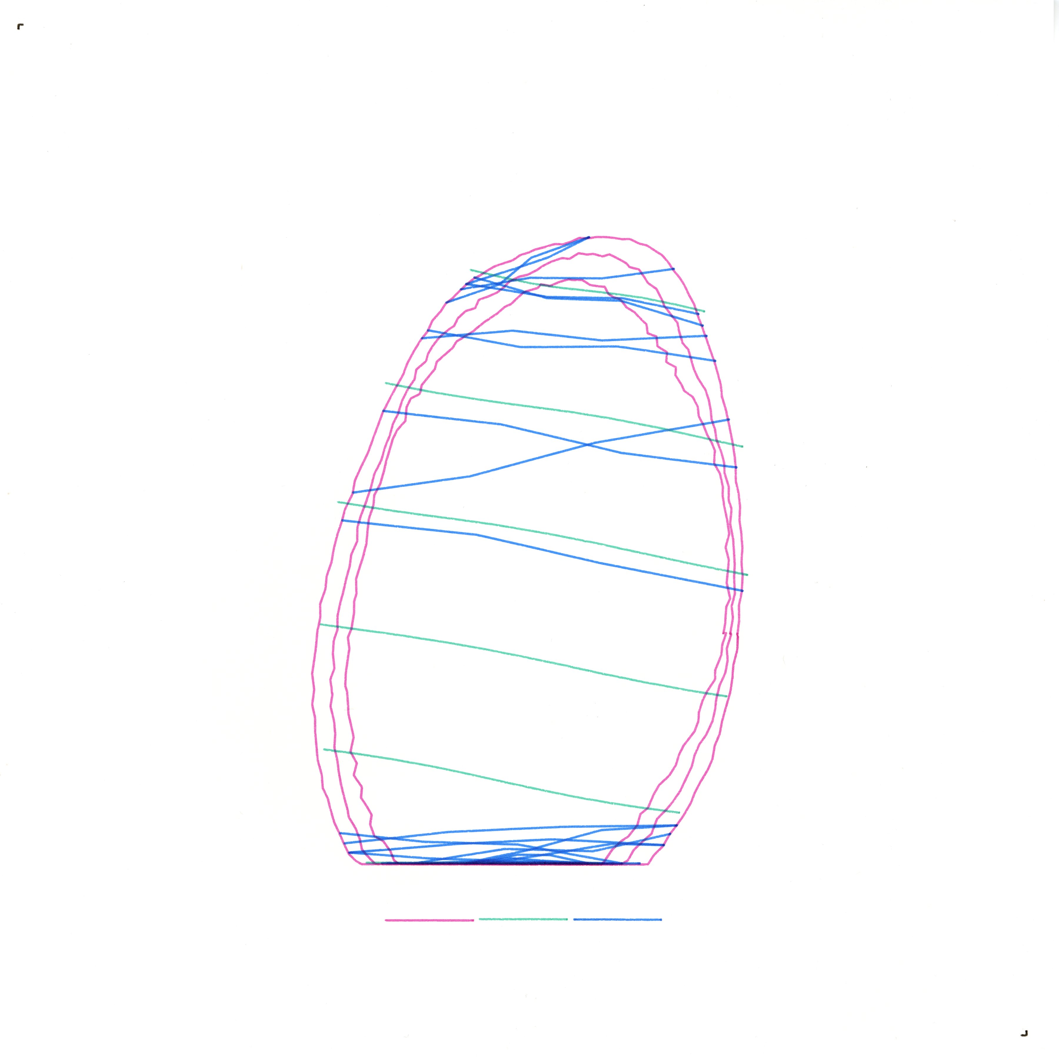 Truss of Ruminations